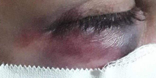 Mulher é espancada e tem unhas arrancadas na frente de filha de três anos