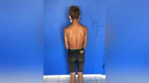 Acusado de atear fogo em moto de policial é preso na zona rural de Cruzeiro do Sul