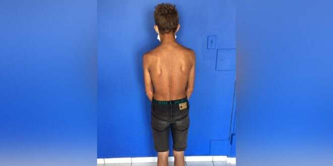 Acusado de atear fogo em moto de policial é preso na zona rural de Cruzeiro do Sul