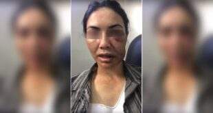 Motorista de app é espancada por ladrões e finge desmaio para não ser morta