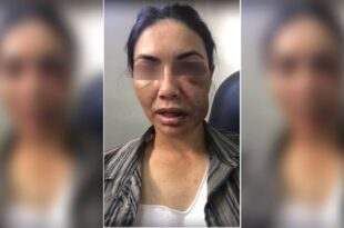 Motorista de app é espancada por ladrões e finge desmaio para não ser morta