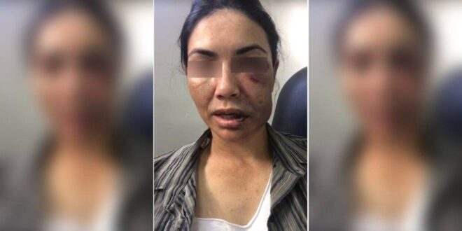 Motorista de app é espancada por ladrões e finge desmaio para não ser morta