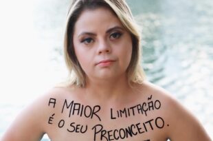 Jovem com síndrome de down rebate ministro da Educação:"O senhor atrapalha o Brasil"