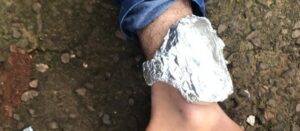 Homem envolve tornozeleira com papel alumínio no Acre para tentar fugir da polícia