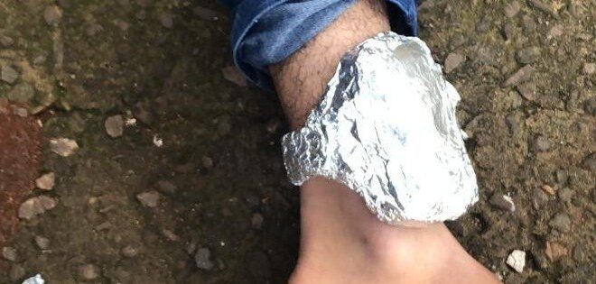 Homem envolve tornozeleira com papel alumínio no Acre para tentar fugir da polícia