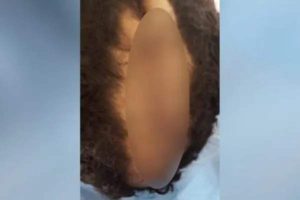 Vídeo: Pai bêbado corta couro cabeludo do filho com faca e alega que corte de cabelo do filho era de “homossexual” 2 Vídeo: Pai bêbado corta couro cabeludo do filho com faca e alega que corte de cabelo do filho era de “homossexual”