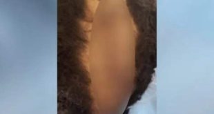 Vídeo: Pai bêbado corta couro cabeludo do filho com faca e alega que corte de cabelo do filho era de “homossexual”