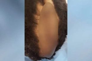 Vídeo: Pai bêbado corta couro cabeludo do filho com faca e alega que corte de cabelo do filho era de “homossexual”