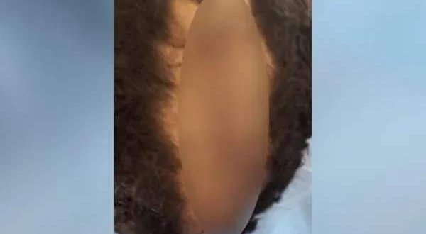 Vídeo: Pai bêbado corta couro cabeludo do filho com faca e alega que corte de cabelo do filho era de “homossexual”
