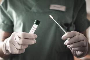 Comissão debate denúncia sobre testes em pacientes com Covid-19 sem autorização da Anvisa