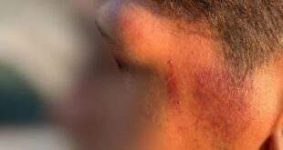 Policiais agridem casal gay com socos e chutes em abordagem