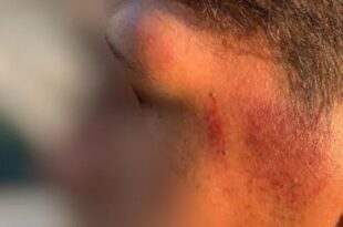Policiais agridem casal gay com socos e chutes em abordagem