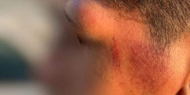 Policiais agridem casal gay com socos e chutes em abordagem