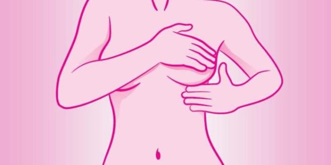 Programa piloto para acompanhar pacientes com câncer de mama reduz tempo para início do tratamento