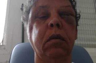 Mulher é agredida de forma brutal ao reagir a assalto no litoral de SP; VÍDEO