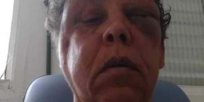 Mulher é agredida de forma brutal ao reagir a assalto no litoral de SP; VÍDEO