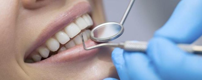 Projeto define prazo de três anos para o fim do uso de amálgama de mercúrio na odontologia
