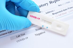 Suspeito de furtar 1.500 testes de Covid é preso em SP