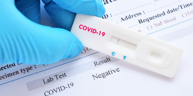 Suspeito de furtar 1.500 testes de Covid é preso em SP