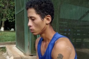 AC: Homem é preso ao carregar corpo com pernas decepadas