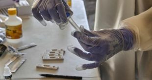 Brasil registrou 314 mortes e 54,22 mil novos casos em 24 horas