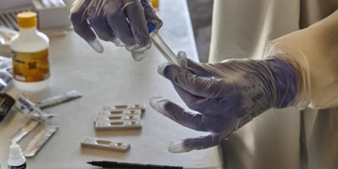 Brasil registrou 314 mortes e 54,22 mil novos casos em 24 horas