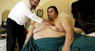 Projeto prevê pena maior para ofensa relacionada à magreza ou obesidade