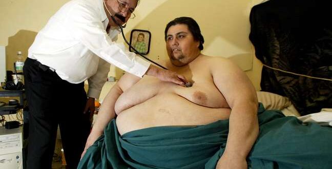 Projeto prevê pena maior para ofensa relacionada à magreza ou obesidade