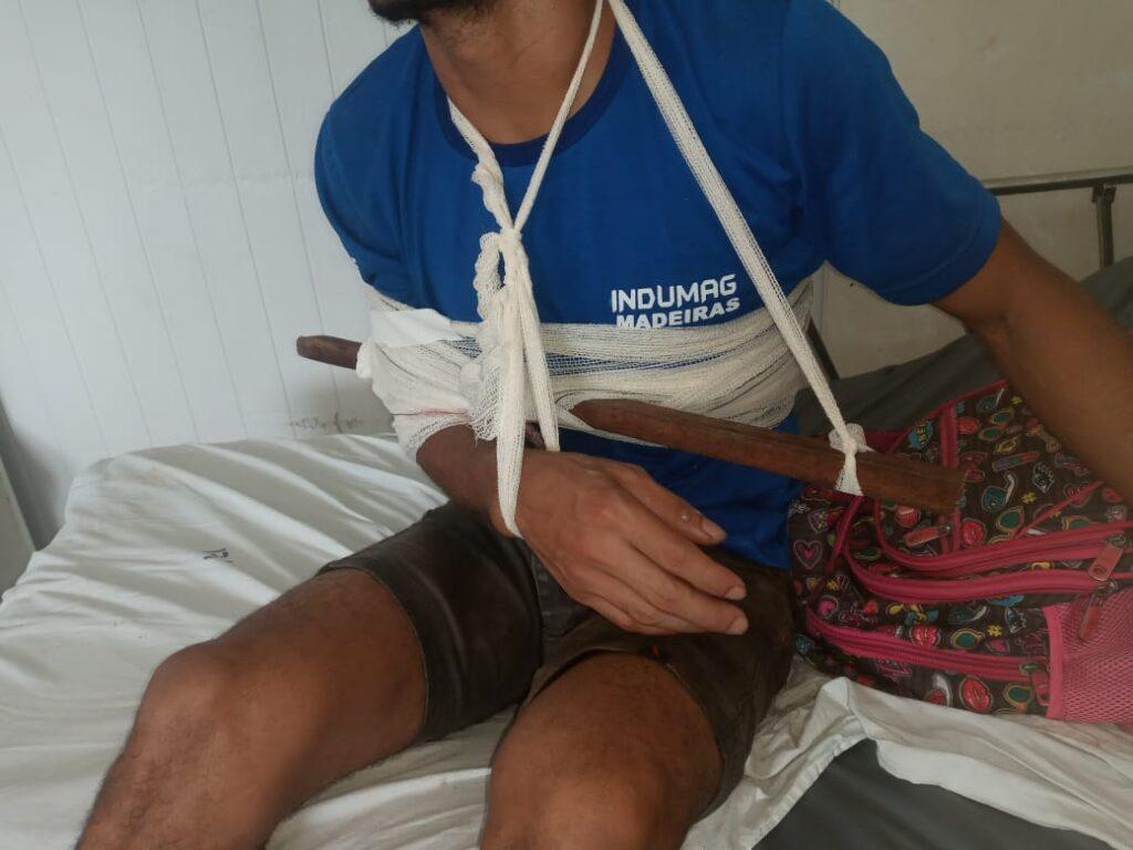 Funcionário de serraria de Sena Madureira sofre acidente de trabalho e fica com pedaço de madeira cravada no braço 2 Funcionário de serraria de Sena Madureira sofre acidente de trabalho e fica com pedaço de madeira cravada no braço