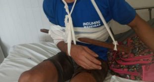 Funcionário de serraria de Sena Madureira sofre acidente de trabalho e fica com pedaço de madeira cravada no braço