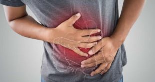 Pandemia fez cair número de exames para detectar câncer de intestino