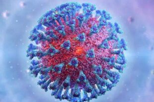 Covid-19 aumenta o risco de Alzheimer, Parkinson e derrames cerebrais
