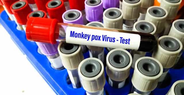EUA registram 2 casos de varíola dos macacos em crianças pela 1ª vez