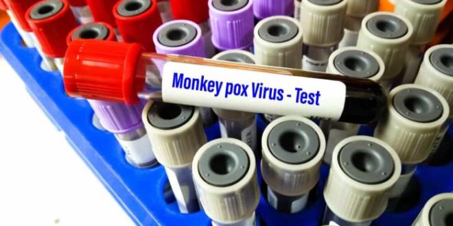 EUA têm o maior número de casos de varíola dos macacos no mundo