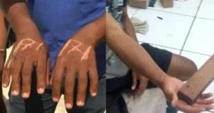 Polícia investiga tortura de funcionários negros em loja na BA