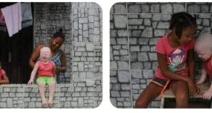 Sequestro de criança albina em Madagascar gera protesto, e repressão deixa 18 mortos