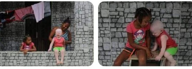 Sequestro de criança albina em Madagascar gera protesto, e repressão deixa 18 mortos