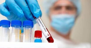 Da testagem ao resultado, conheça como é feito o diagnóstico para monkeypox