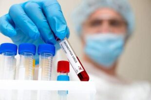 Da testagem ao resultado, conheça como é feito o diagnóstico para monkeypox