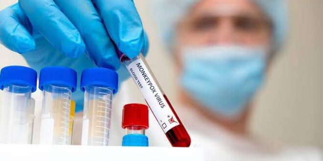 Da testagem ao resultado, conheça como é feito o diagnóstico para monkeypox