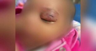 Pai dá soco no rosto da própria filha de 1 mês; veja o caso