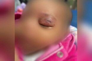Pai dá soco no rosto da própria filha de 1 mês; veja o caso