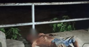 Rio Branco: morador de rua é agredido por travesti a tijoladas e chutes na cabeça enquanto dormia