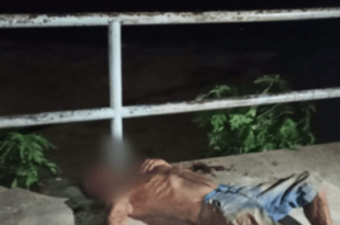 Rio Branco: morador de rua é agredido por travesti a tijoladas e chutes na cabeça enquanto dormia