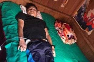Morre paciente atingido pelo desabamento do forro do hospital em Sena Madureira