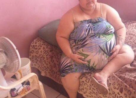 Acreana com quase 200 quilos pede ajuda e ganha campanha de doação na internet