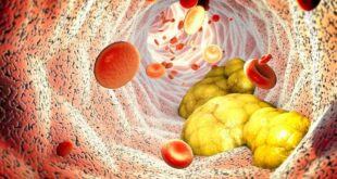 Níveis no limite? Os alimentos que mantêm o colesterol sob controle