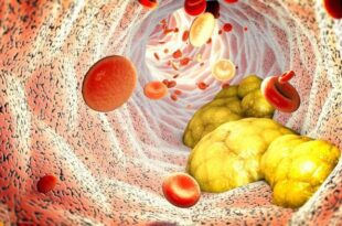 Níveis no limite? Os alimentos que mantêm o colesterol sob controle