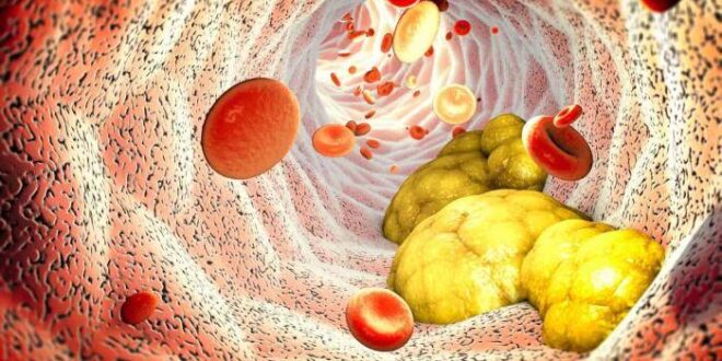 Níveis no limite? Os alimentos que mantêm o colesterol sob controle