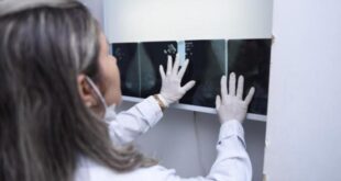 Centro de Controle Oncológico busca mais de 1,5 mil pacientes que não retiraram resultados de exames